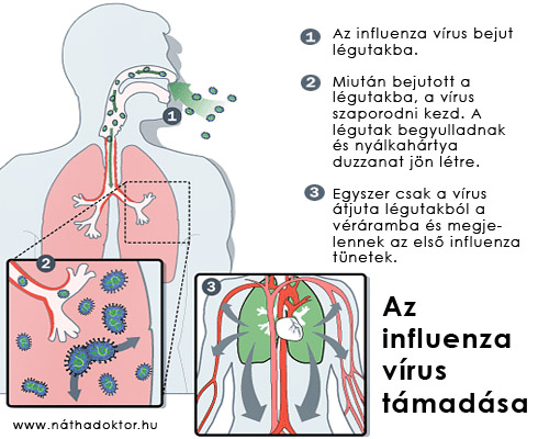 influenza