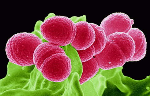 neutrophil granulocitk fagocitaljk a Streptococcus pyogenes baktriumoka
