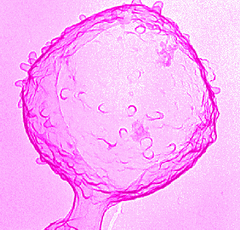 Streptococcus pyogenes elektron mikroszkpos felvtelen